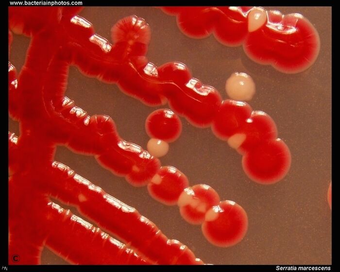 Adopt a Bacterial Pigment : Serratia marcescens' Prodigiosin. | A