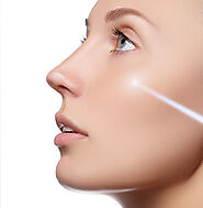 eCO2 Skin Resurfacing Laser Treatment | Radium Medical Aesthetics Singapore
