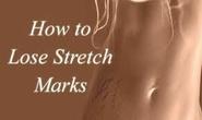 How To Prevent Stretch Mark Using Intensive Stretch Mark Therapy ~ In Demand Health Products Worldwide