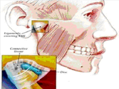 TMJ-Non Surgical Tips and Exercises for TMJ-Temporomandibular Joint Pain - Smiles Better