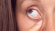 Foreign Object in Eye - Symptoms, Prevention and How to Remove It.