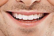 Best Cosmetic Dental Procedures to Boost Your Smile Quality