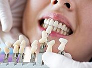 Why You Shouldn't Ignore Going for Dental Crowns? Pearl Dental Group