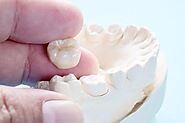 What Are the Alternatives for a Dental Crown? - Pearl Dental Group