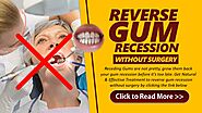 How Do You Reverse Receding Gum Line?
