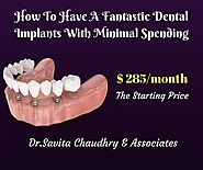 Dr. Savita Chaudhry Dental Clinic | Etobicoke Smile Dentist