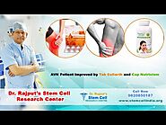 AVN patient improved by Tab Collarth and Cap Nutristem, new approach by Dr B S Rajput, 9820850187