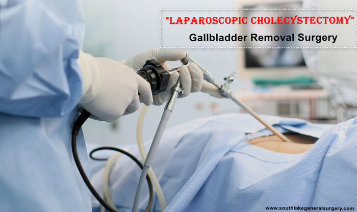 Gallbladder Laparoscopic Treatment in Southlake, Texas A