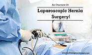 Laparoscopic hernia surgery Texas