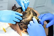 PRP HAIR RESTORATION - AnewSkin Aesthetic Clinic and Medical Spa