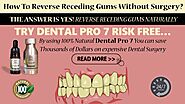 How To Reverse Gum Loss Naturally?