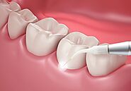 The Most Reputable Dentist In San Diego Will Help You Attain A Perfect Set Of Teeth