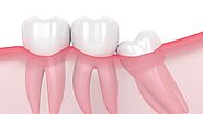 Dentist In San Diego Offering Solutions To Your Oral Health Needs.