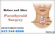 Parathyroid surgery southlake