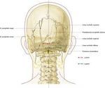 Get The Detailed Information About Occipital Nerve Block (Health & Fitness-Occipital Nerve Blocks Anchorage)