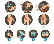 जलने की चोटों से निपटने के लिए एक व्यापक गाइड - सुझाव - टिप्स