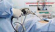 Laparoscopic Gallbladder Removal Surgery | Gallstone Treatment Texas | Recovery