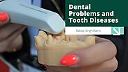 Dental Problems and Tooth Diseases - Baldip Singh Bains