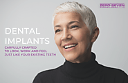 Receive Dental Implants at our dental practice in London!