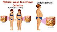 Top Natural ways to Reduce Cellulite in the Body-without Surgery or Lipo