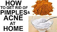Home Remedies for Acne - Philadelphia Holistic Clinic - Dr. Tsan & Assoc.