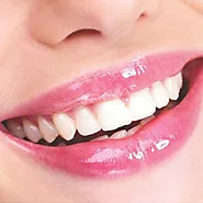 Teeth Whitening in Islamabad, Rawalpindi & Pakistan | Laser whitening