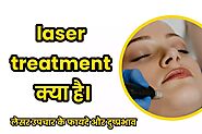 Laser treatment for ance scars | फायदे, नुकसान, इत्यादि