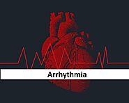 Signs, And Symptoms Of Arrhythmias
