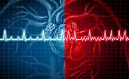 What Are The Symptoms Of Arrhythmia?
