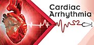 Symptoms Of Arrhythmia- Dr Aparna Jaswal Cardiologist