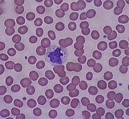 What is a white blood cell count?