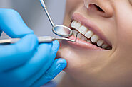 The Reputable San Diego Dentist Will Help You With Dental Implants.