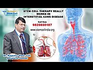 ILD-Stem cell therapy really works in Interstitial Lung disease-Dr Rajput, +91 9820800187,9820850187