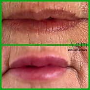 Lip Enhancement for Natural Looking