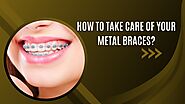 How to Take Care of Your Metal Braces?
