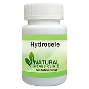 Decrease the Swelling of Scrotum with Natural Remedies for Hydrocele