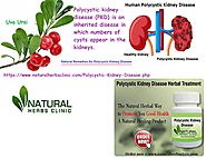 Herbal Ingredients which used in Natural Remedies for Polycystic Kidney Disease