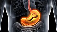 Do You Know How H. Pylori is Diagnosed and Treated?