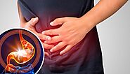 Do You Know the 5 Home Remedies for Gastritis?
