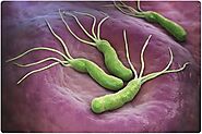 H. Pylori Infection: Everything You Should Know in 2022