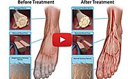 Neuropathy Revolution System Review