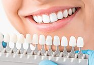 Teeth Whitening - BEDC