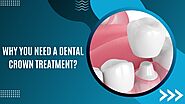 Why You Need a Dental Crown Treatment?