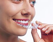 Caring for Your New Smile after Invisalign Treatment