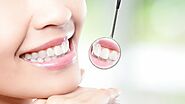 Exploring Outstanding Dental Care in Scottsdale