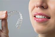 Budget-Friendly Invisalign Solutions for Your Perfect Smile