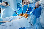 Laparoscopy a modern surgical wonder | Dr Sheela Chhabra