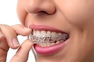 Blasting the Myths: Invisalign for St. Clair Shores