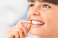 Take Care of Your Smile after Invisalign Treatment
