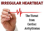 Irregular Heartbeat – The Threat from Cardiac Arrhythmias